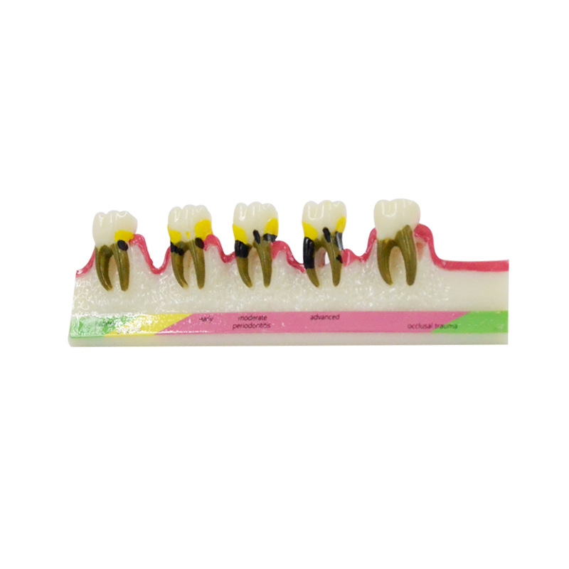 Periodontal Disease Model Dent - đánh giá và giá Medical Lab Study
