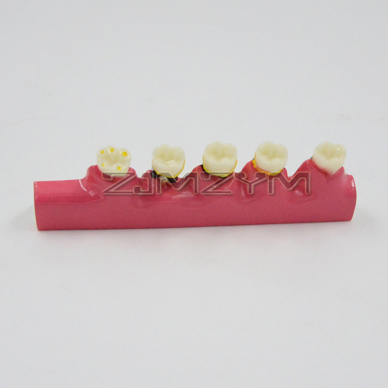 Periodontal Disease Model Dent - đánh giá và giá Medical Lab Study