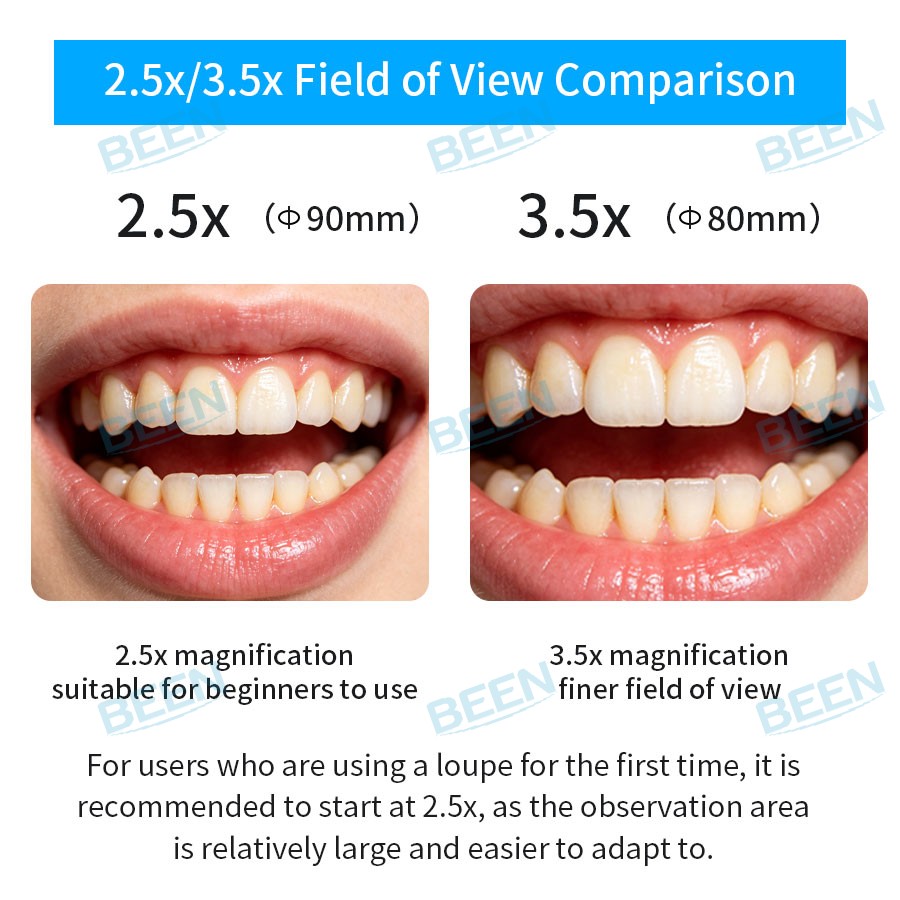 2.5x420mm Dental Loupes Dental - đánh giá và giá Medical Lab Usa
